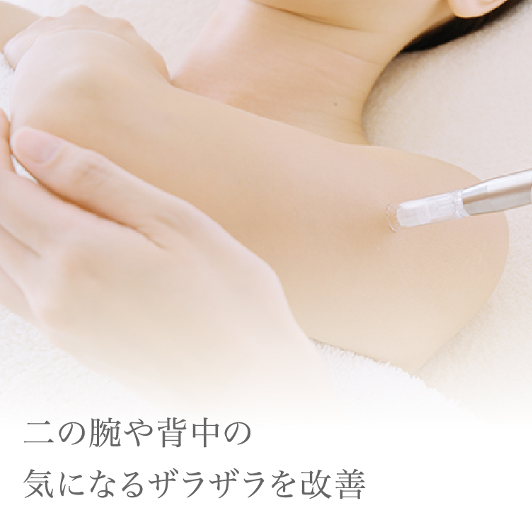 毛孔性苔癬治療 二の腕 背中のぶつぶつ 美容皮膚科タカミクリニック 東京 表参道