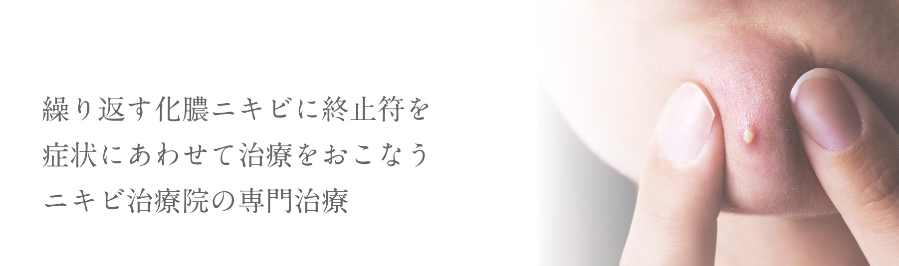 繰り返す化膿ニキビに終止符を症状にあわせて治療をおこなうニキビ治療院の専門治療