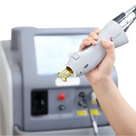 医療用レーザー脱毛