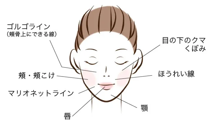 乾燥肌のニキビが発生しやすい場所