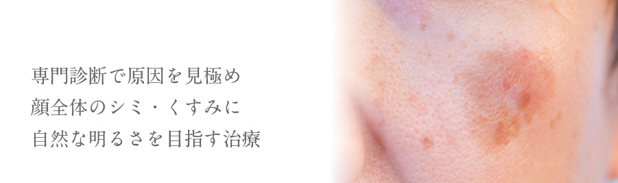 専門診断で原因を見極め顔全体のシミ・くすみに自然な明るさを目指す治療