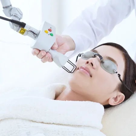 フラクショナルレーザー治療