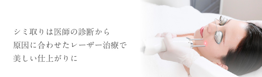 シミ取りは医師の診断から原因に合わせたレーザー治療で美しい仕上がりに