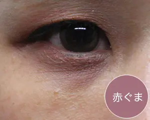 赤ぐま